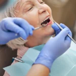 Implants section 1