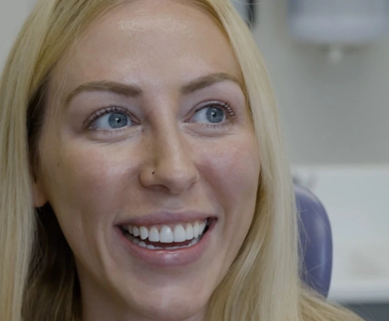 Porcelain Veneers section 5