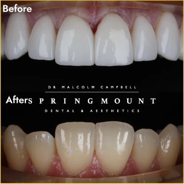before_after_ 1