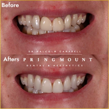 before_after_2