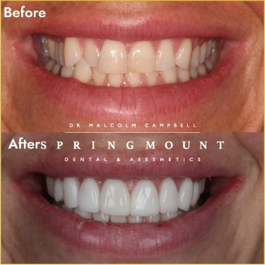 before_after_3